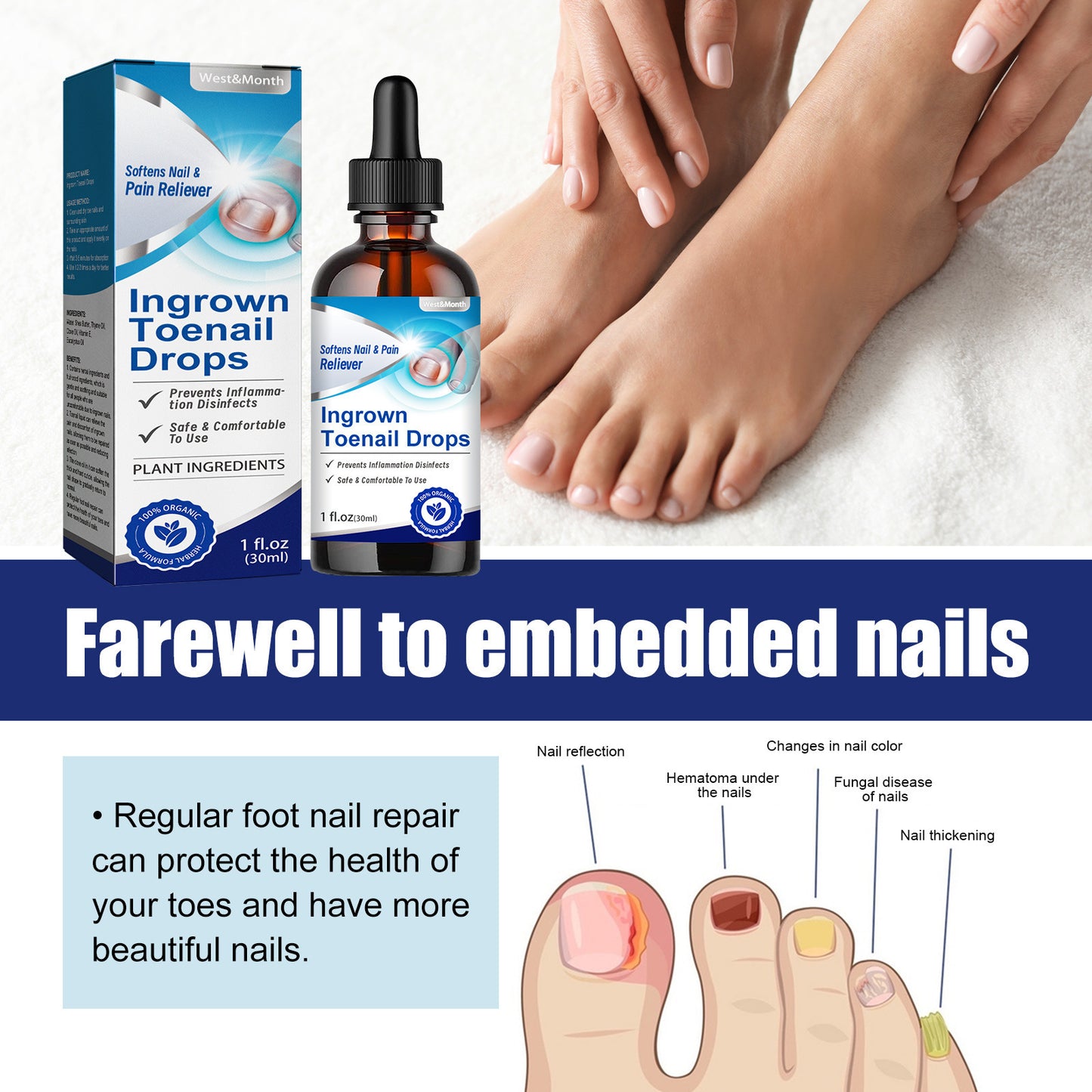 Embedded Nail Repair Skin Moisturizing Lotion