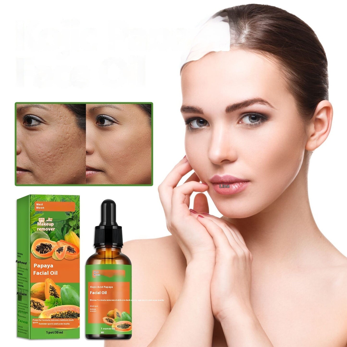 Papaya Tartaric Acid Facial Skin Moisturizing Lotion