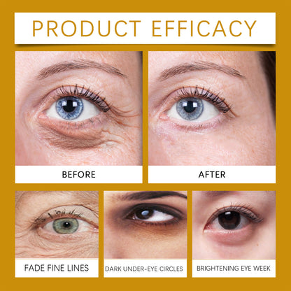 Retinol Eye Cream Moisturizing Fading Wrinkle