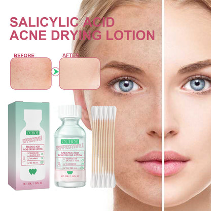 Salicylate Acne Lotion Mild Repair