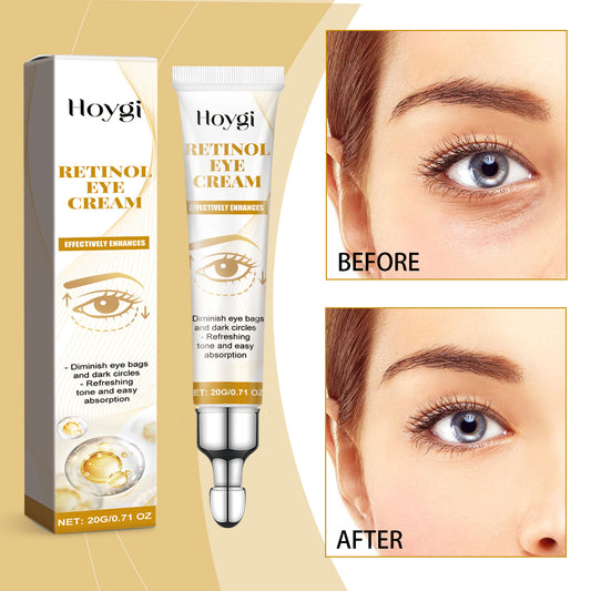 Retinol Eye Cream Moisturizing Fading Wrinkle